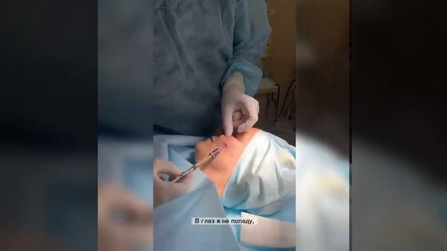 Липофилинг лица смотреть онлайн