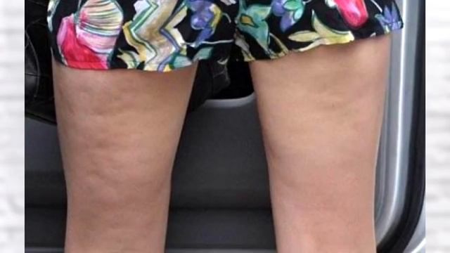 Природные средства при отекших лодыжках и стопах. Они могут помочь смотреть онлайн