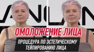 ✅ ОМОЛОЖЕНИЕ ЛИЦА.  ПРОЦЕДУРА ПО ЭСТЕТИЧЕСКОМУ ТЕЙПИРОВАНИЮ ЛИЦА | Валентин Гайт | BBALANCE