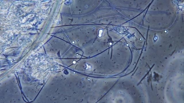 Bacteria Of Dental Plaque Under The Microscope