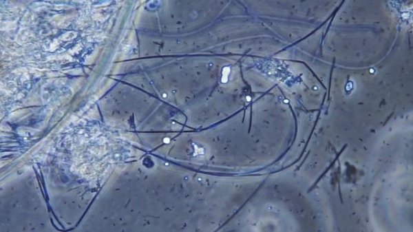 Bacteria of dental plaque under the microscope