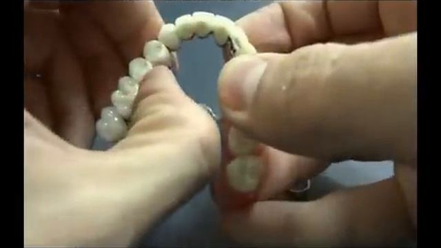 Bugel_attachment_lv-rudent.mp4