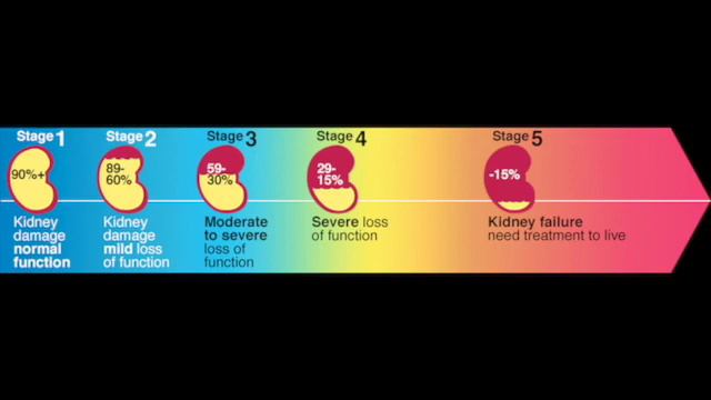 Renal System: PANCE Preparation смотреть онлайн