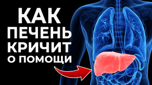 ТОП-3 признака больной ПЕЧЕНИ | Узнай про заболевания печени за секунду!