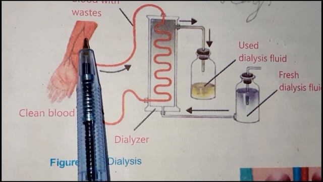 Class 8 | Science | Chapter 1 | Renal failure | By Excel School смотреть онлайн