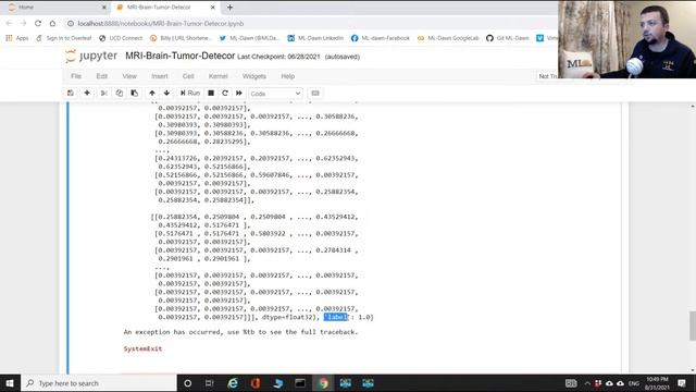 9- Iterate through the MRI Dataset (Part-1): Using For Loop and Next(Iter) commands смотреть онлайн