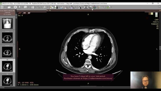 Основные КТ проэкции Аксиальная Корональная Сагитальная смотреть онлайн