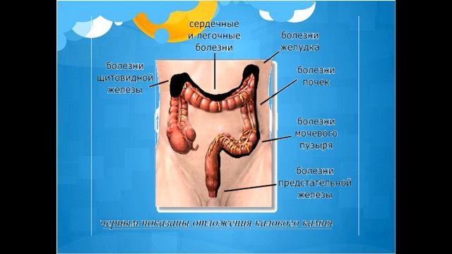 ЧИСТЫЙ КИШЕЧНИК - ДОЛГАЯ ЖИЗНЬ смотреть онлайн