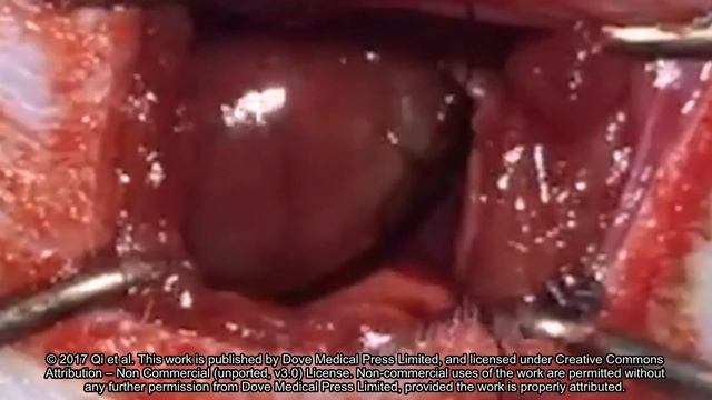 Spatiotemporal delivery of nanoformulated liraglutide - Supplementary video 1 [132064] смотреть онлайн