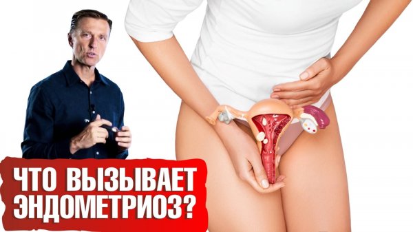 Эндометриоз: причины и пути решения проблемы🧘♀️