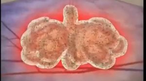 Как Лечить Фурункул