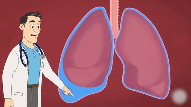 Pleural effusion : Types and Causes смотреть онлайн