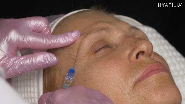 Fullface/ Филлеры HyaFilia Classic 1 ml, HyaFilia Petit 1 ml, HyaFilia Grand 3 ml смотреть онлайн