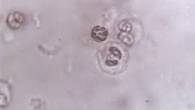 Лейкоциты смотреть онлайн