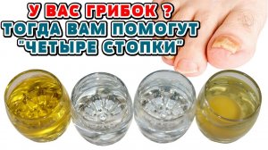 Запущенный ГРИБОК Стоп и Ногтей Легко Вылечить с Помощью 4-х СТОПОК! Не Кормите Аптеки!