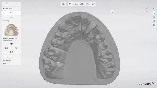 3Shape - Scanner da série E - Interface do usuário do ScanIt Dental смотреть онлайн
