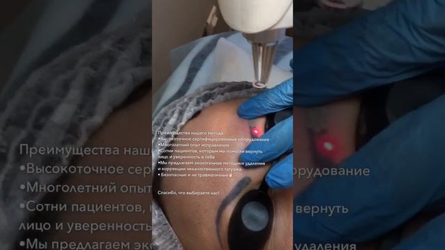 Удаление бровей неодимовый лазер Консультация и запись по ?92-888-32 ?9-(911)-92-888-32 WApp/Viber смотреть онлайн