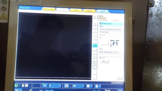 Philips digital directo (digital diagnost c50), equipo de rayos x, técnicas radiológica, radiología смотреть онлайн