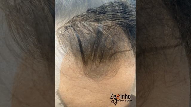 Prótese Capilar Zezinho - Antes e Depois Evolution смотреть онлайн