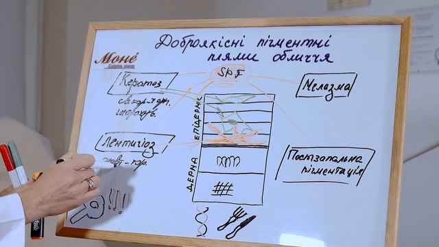 Пігментні плями обличчя.Які? Чому? Що робити? смотреть онлайн