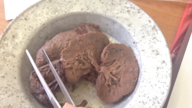 Строение почек смотреть онлайн