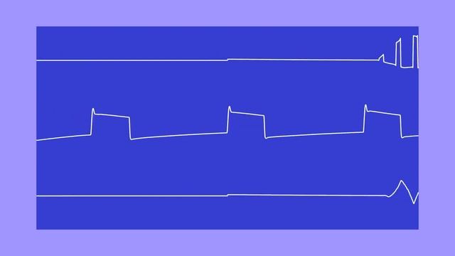 SONIC C64 [PAL] - Jungle Zone - 8-Bit - SID Music (Oscilloscope View) смотреть онлайн