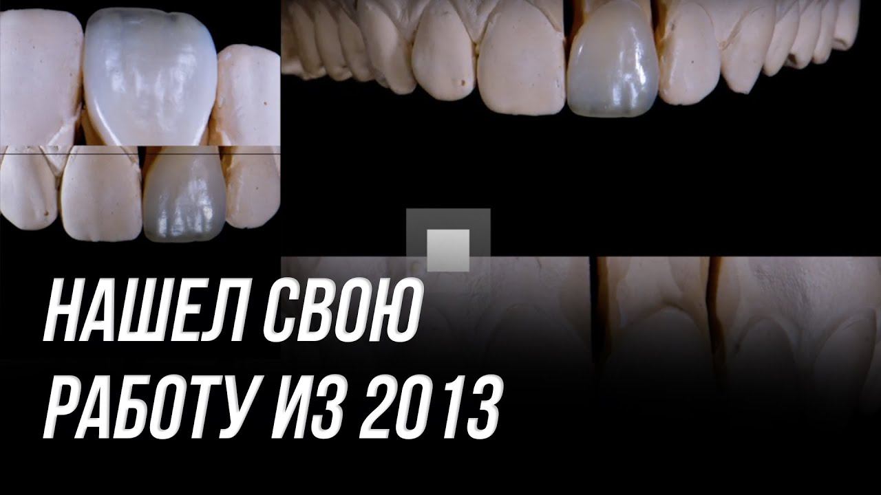 Зубной техник обучение с нуля. Моя работа с 2013 года. Как я научился работать сам зубным техником смотреть онлайн