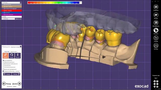 Exocad Моделировка каркасов под Металокерамику и Цельнолитую коронку смотреть онлайн