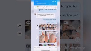 Combo Dành Cho Trường Hợp Gàu, Nấm Da Đầu Lâu Năm - Nặng