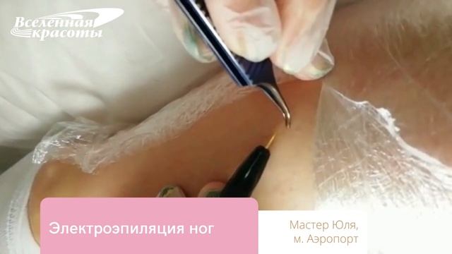 Электроэпиляция ног методом Blend