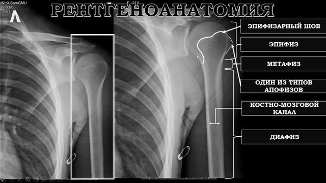 КОСТЬ КАК ОРГАН. ЛУЧЕВАЯ АНАТОМИЯ КОСТИ. ВОЗРАСТНЫЕ ОСОБЕННОСТИ КОСТНОЙ ТКАНИ смотреть онлайн