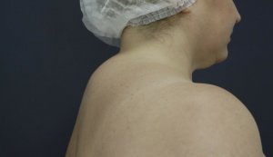 Вдовий горб.