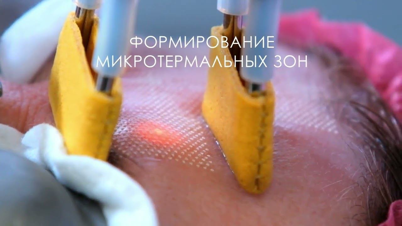 Экраны 2024 смотреть онлайн