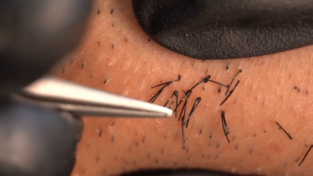 пинцет Захватывающее видео Следить заАСМР,2021/4/16 смотреть онлайн