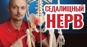 РАЗБЛОКИРУЕМ СЕДАЛИЩНЫЙ НЕРВ⚡ и устраняем боль за 2 минуты!
