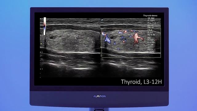 E-Cube 8 ультразвуковой сканер