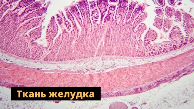 Почему желудок не переваривает сам себя? смотреть онлайн