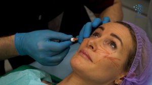 Мастер-класс с курса: «Контурная пластика FULL FACE»