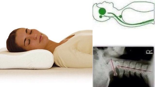 Вредны ли ортопедические подушки для шеи и позвоночника. Ответ врача. смотреть онлайн