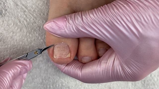 Педикюр на себе? Раскрываю секреты? Опять подногтевая мозоль смотреть онлайн