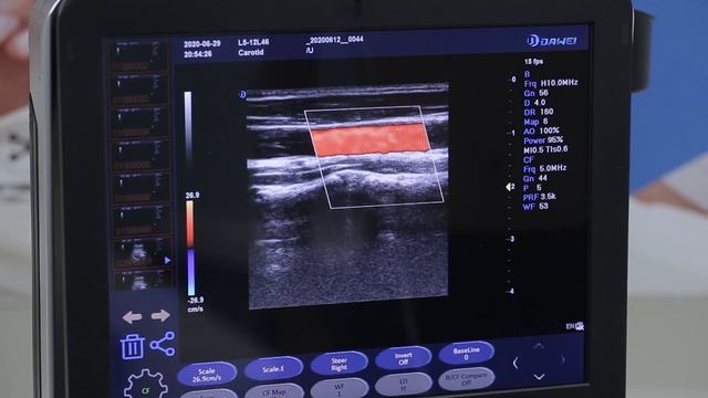 China 3D 4D Color Doppler Portable baby Scanner Echo Ultrasound ultrasonography machine смотреть онлайн
