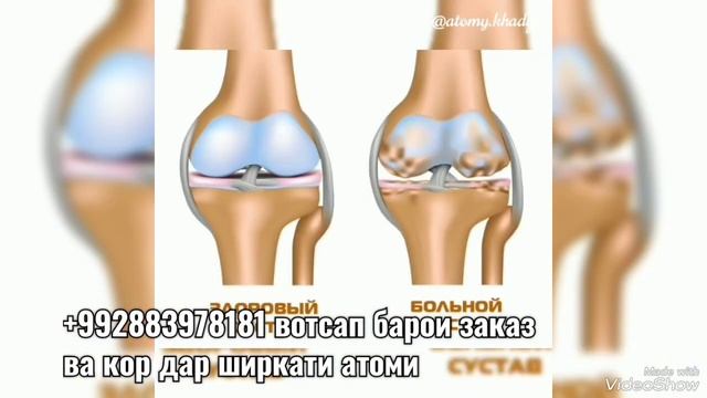 КАРАЛЕВСКИЙ БАРХТ ВА МОКРЫЙ БАРХТИ ТОЗА ОМАД