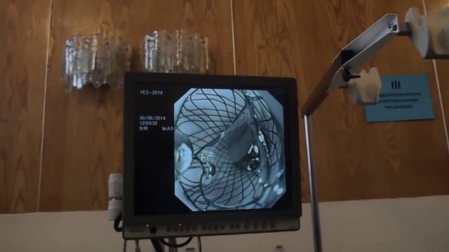 Мастер класс Стентирование пищевода & EndoClot смотреть онлайн