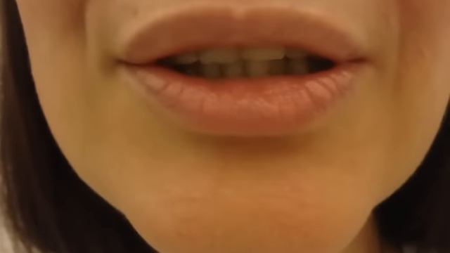 Съёмный зубной протез спустя пол года  .  отзыв # 6