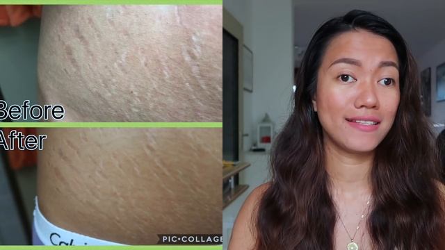 WISH APP PASJEL STRETCH MARKS CREAM REVIEW | DOES IT WORK? смотреть онлайн