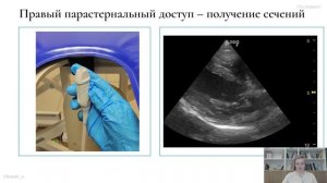 ВНУТРИ КУРСА | Проекции УЗИ сердца, ЛГ, патологии, протокол ЭХО у собак и кошек | Онлайн-курс по ЭХО