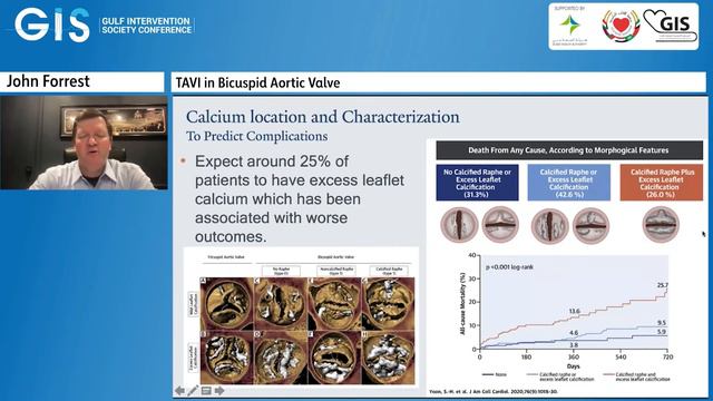22 John Forrest TAVI in Bicuspid Aortic Valve смотреть онлайн
