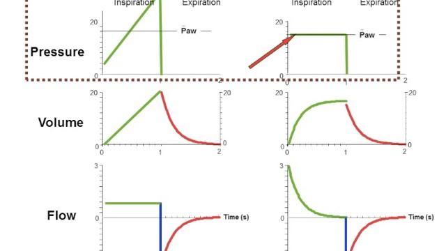Режимы ИВЛ 5. CMV  Горячев А.С.
