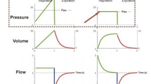 Режимы ИВЛ 5. CMV  Горячев А.С.