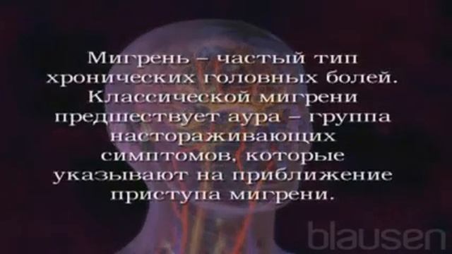 Что такое мигрень? смотреть онлайн